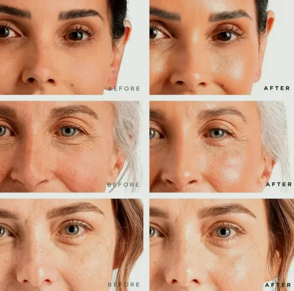 Tree of Face Set For Firming Set