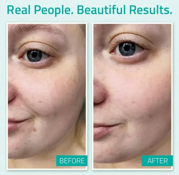 Pure HA Hydrating Serum for Dull Complexion