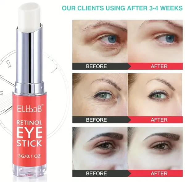Anti-Wrinkle Eye Cream for Swollen Eyes and Shadowed Circles