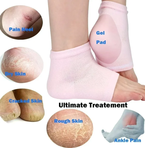 Ultimate Cracked Foot Treatment Gel Socks Bundle