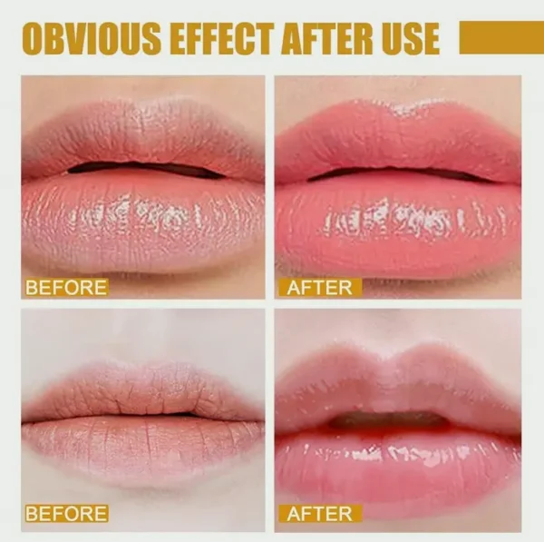 Hydrating Bee Lip Care Set