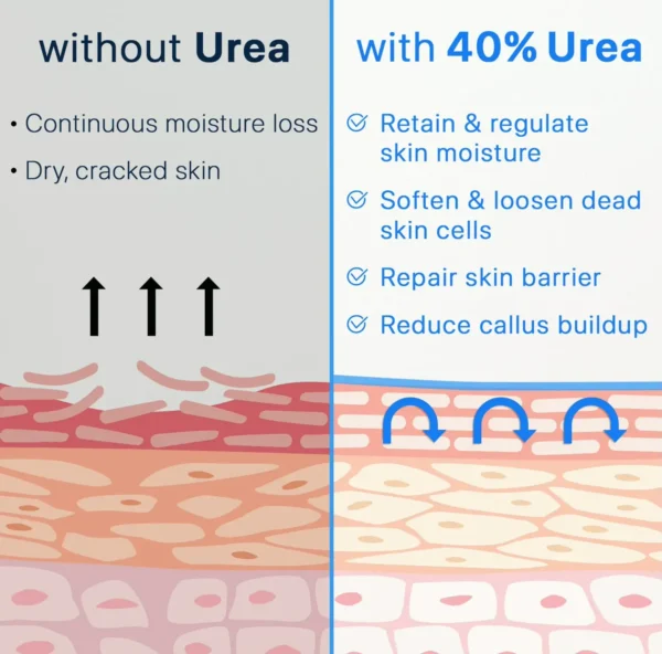 Ebanel Urea Cream 40% + Salicylic Acid 2%, Skin Cream for Cracked Feet