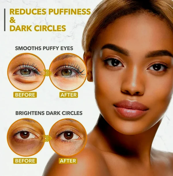 Eye Mask for Dark Circles and Eye Bags, 24k Skincare Treatment