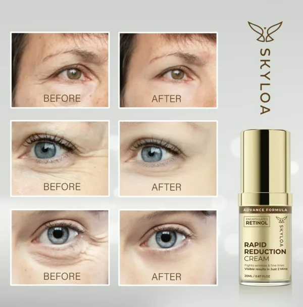 Retinol Eye Cream for Dark Circles and Wrinkles