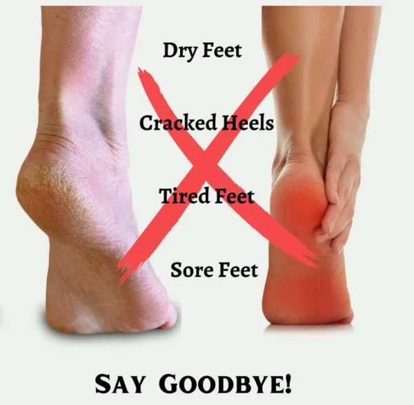 Peppermint, Herb & Eucalyptus Therapy Feet Cream - Fixes & Moisturizes